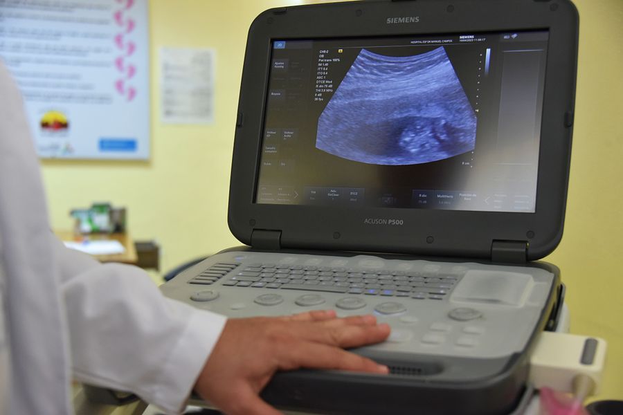 Imagen alusiva a Ecocardiografía transesofágica