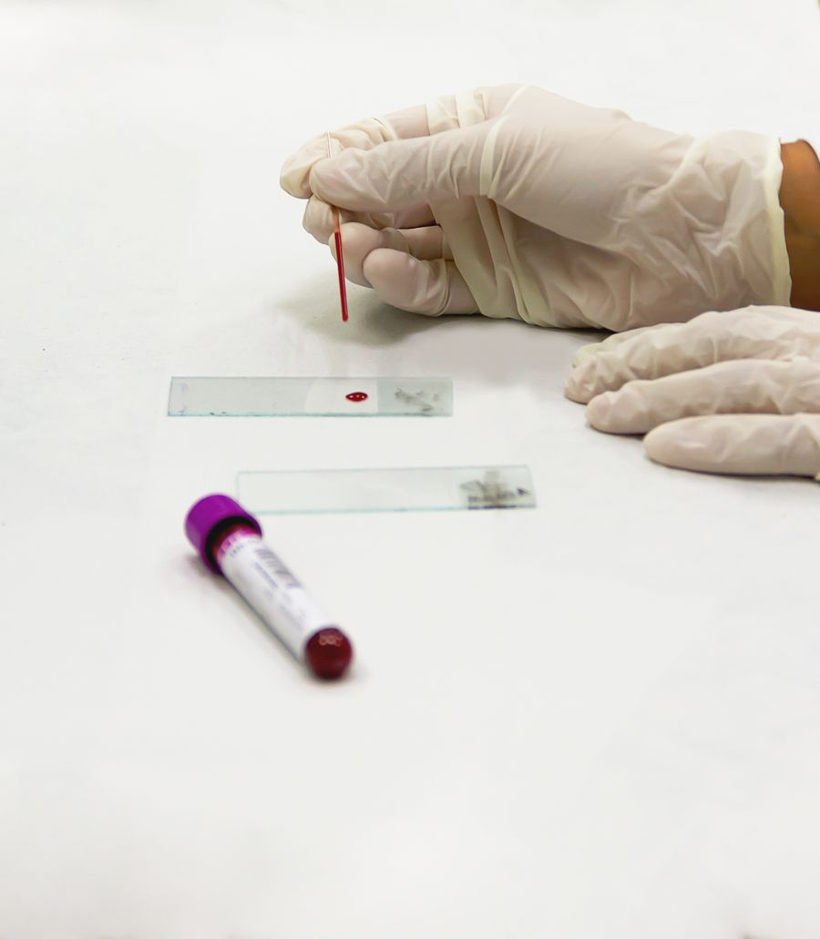 Imagen alusiva a Análisis de sangre como apoyo al diagnóstico clínico
